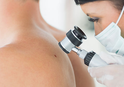 Mole examination